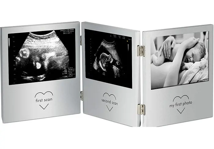 A triple-scan photo frame showing two sonar scans and the first picture of the baby all in one frame. 